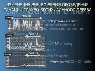 Коррекция внутричерепной гипертензии при ЧМТ