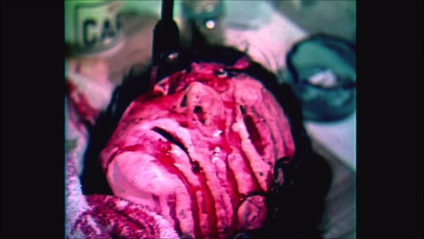 The Gore Gore Girls (1972)