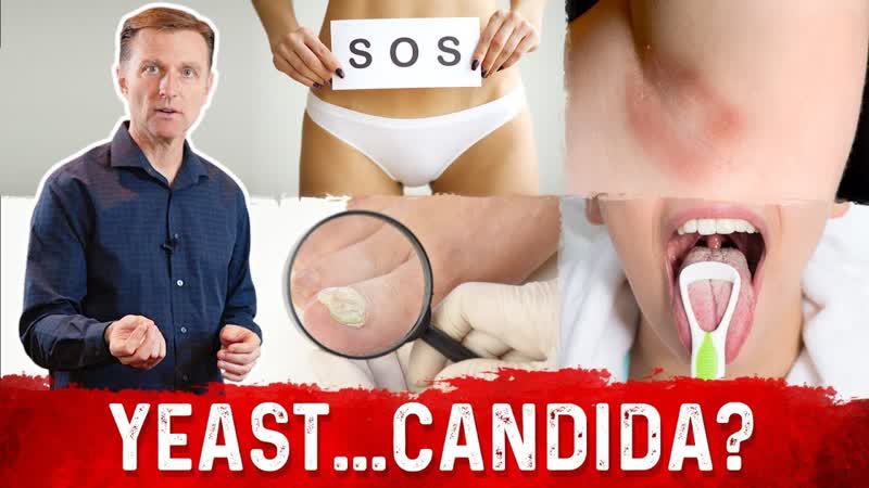 Yeast Infection vs Candida Infection: Is there a