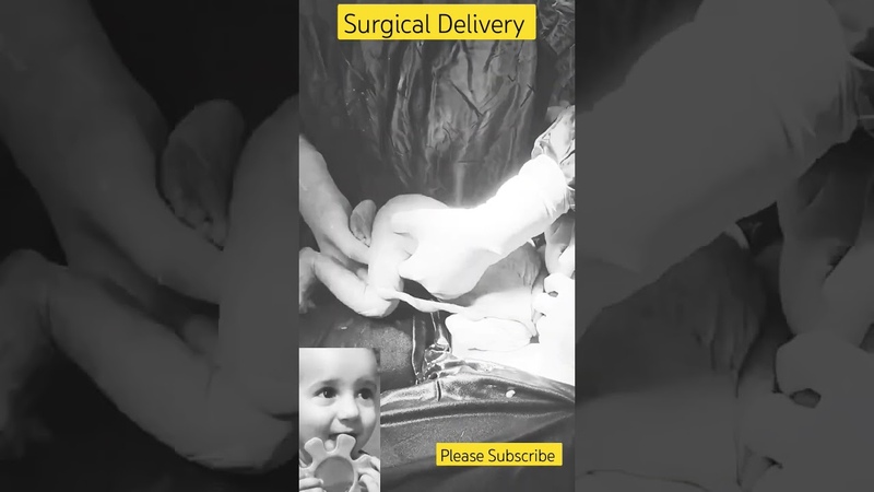 Surgical Baby Delivery, Charming Baby Girl Born, Surgicaldelivery,