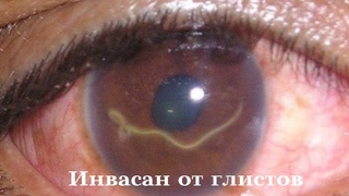 Инвасан от глистов