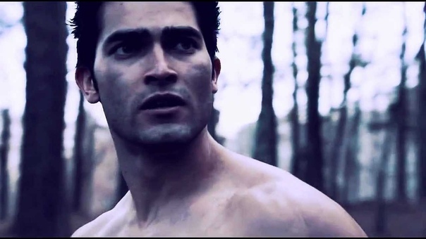 Teen wolf , D U B S T E
