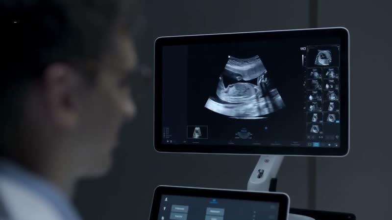 Аппарат УЗИ Samsung Medison