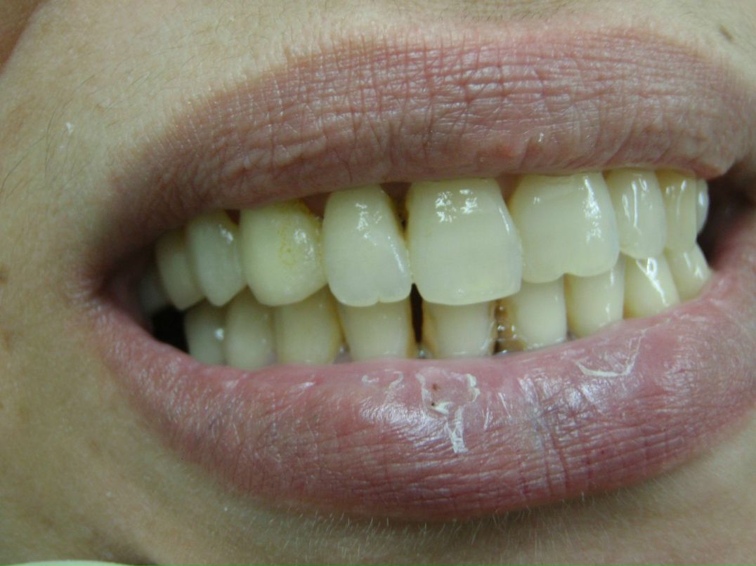 Эрнест Абрамян | Москва