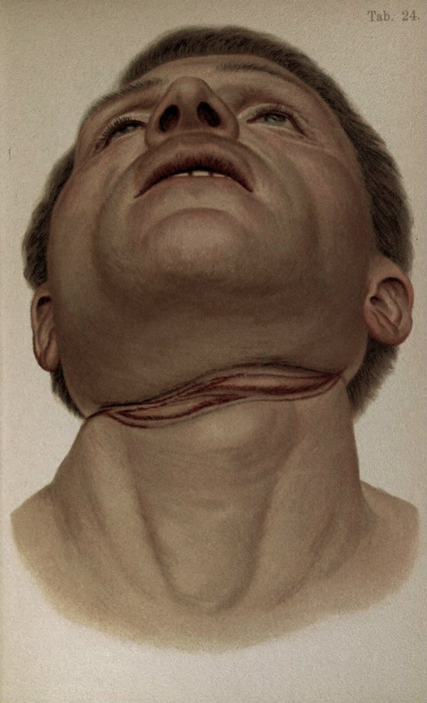 Vlad Go | Северодвинск