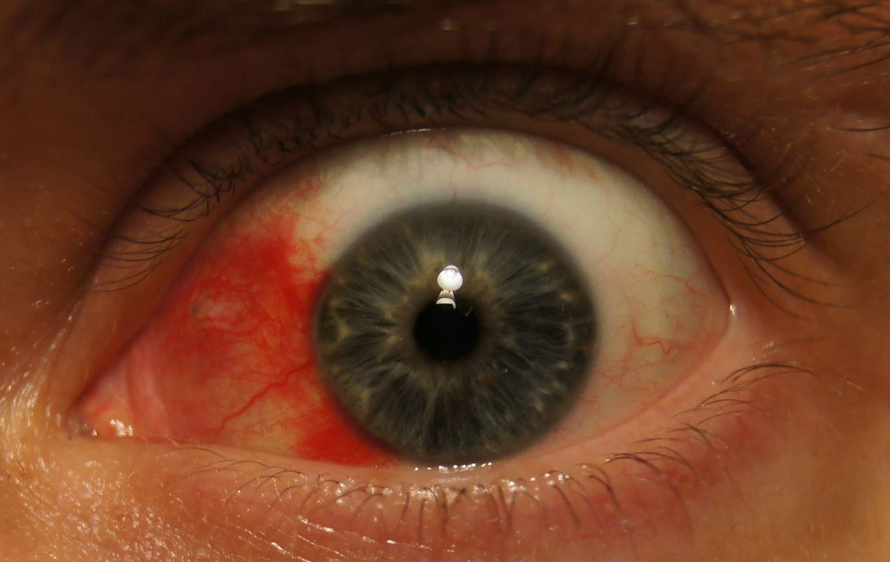 Сява Ремизов (возимеР) | Санкт-Петербург