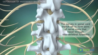 Pregnancy back pain Definition